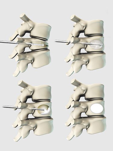 cifoplastia-dr-jose-alberto