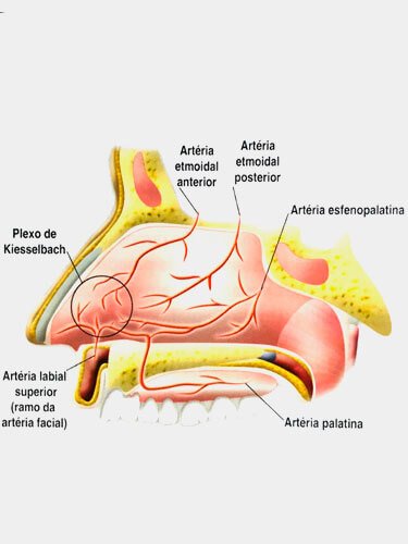 sangramento-nasal